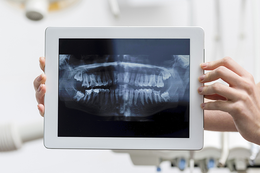 デジタルレントゲン